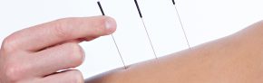 Akupunktur - medicinsk
